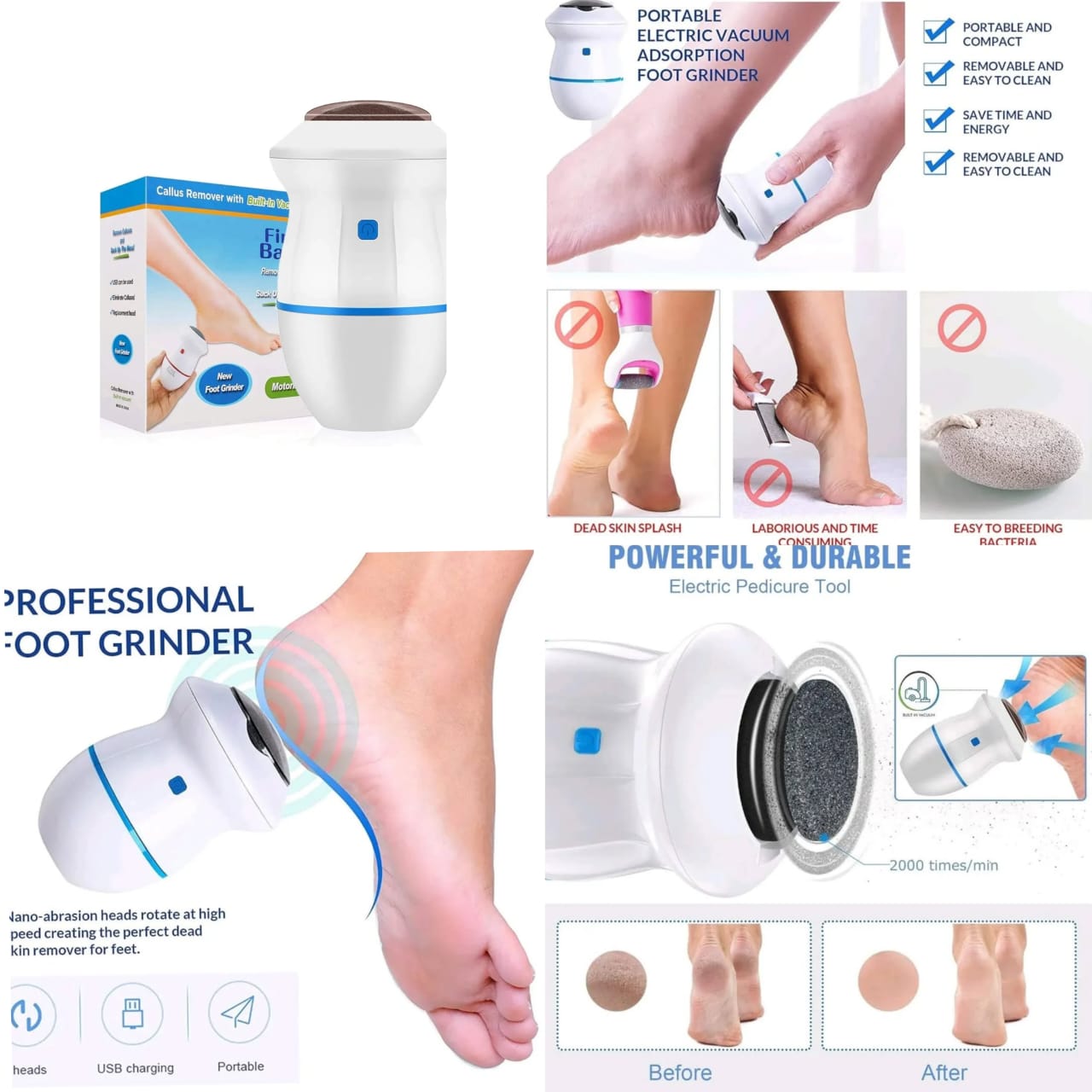 Electric Foot Callus Remover